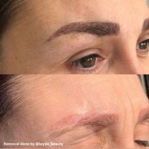 Instagram - Results (10)